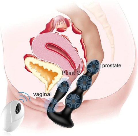 RemoteSilicone AnalBeads B - Series Cute